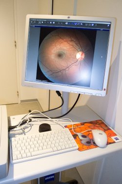 Rétinographe non mydriatique